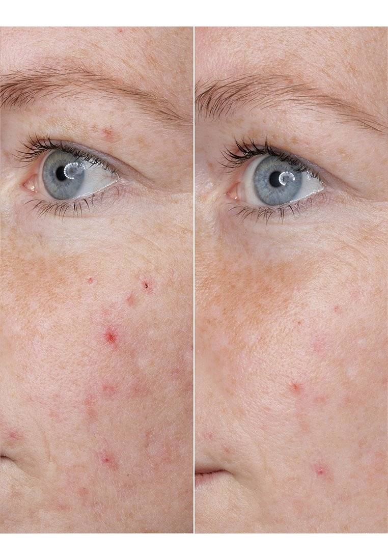 BABOR BABOR HYALURONIC ACID AMPOULE - Serum Exklusive Angebote